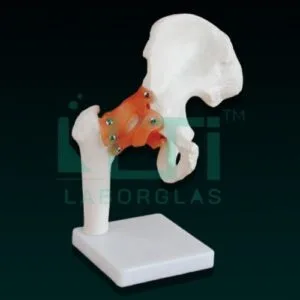 10360-HIP JOINT
