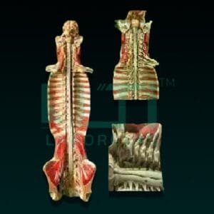 10420-SPINAL CORD IN THE SPINAL CANAL